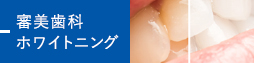 審美歯科 ホワイトニング